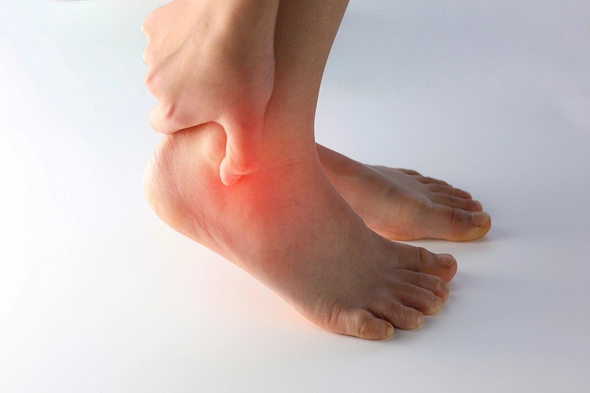image depicting Achilles tendinopathy